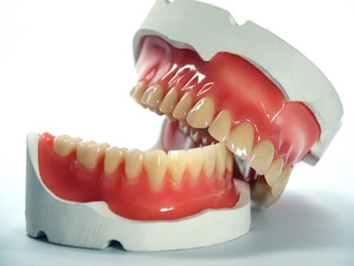 two-part-denture