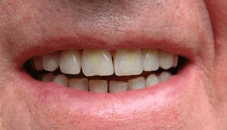 teeth-mouth-treatment
