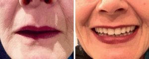 female-teeth-good-vs-bad