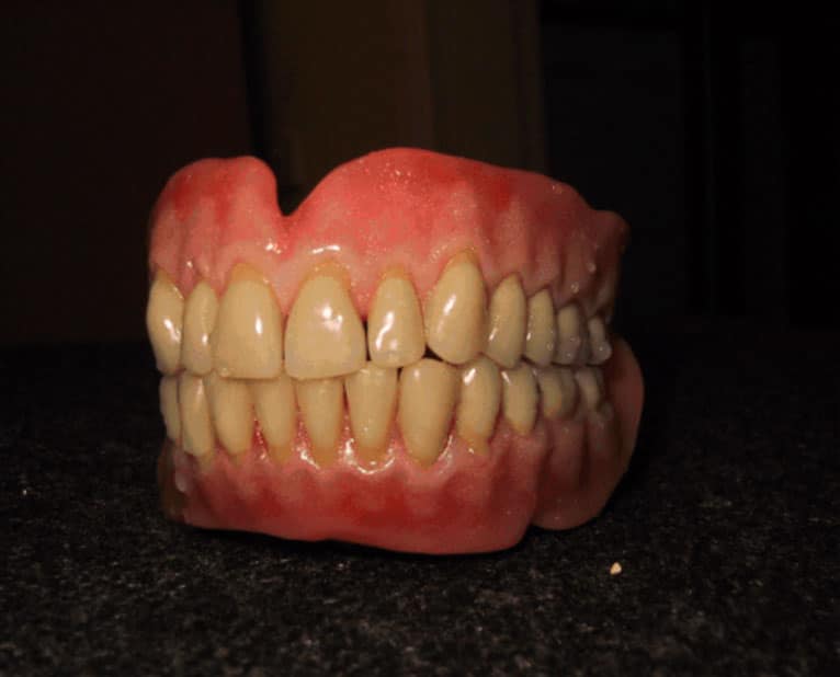 ultra-grip-denture-model
