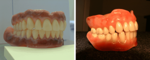 gums-teeth-models