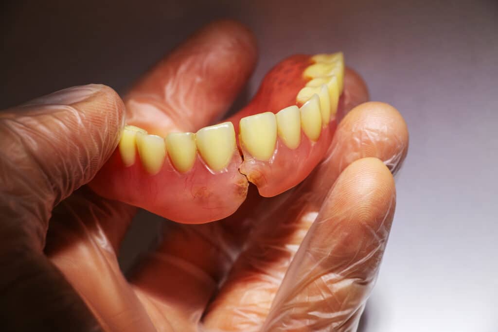 Denture Repairs Manchester - sMiles Better Dental